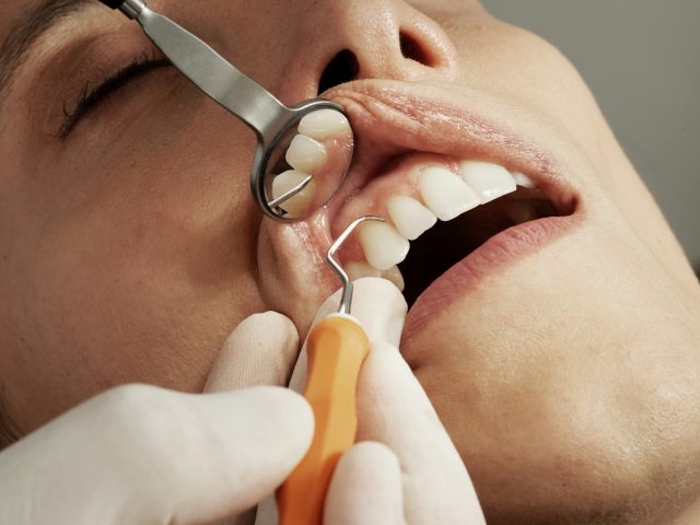 Douleurs dentaires avant les règles : pourquoi les hormones sont coupables